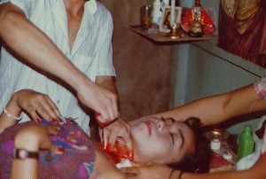 Ариго – бразильский хилер () Ариго – бразильский хилер