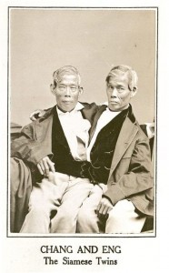 Сиамские близнецы: вместе на всю жизнь () Сиамские близнецы: вместе на всю жизнь