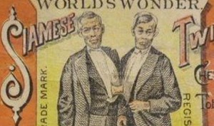 Сиамские близнецы: вместе на всю жизнь () Сиамские близнецы: вместе на всю жизнь