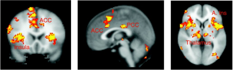 Учёные нашли "выключатель" боли