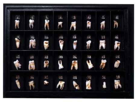 История зубоврачевания от древности до наших дней () История зубоврачевания от древности до наших дней