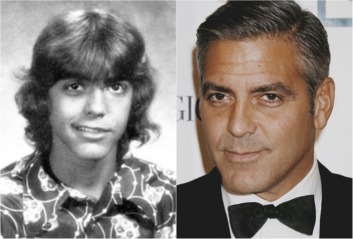 Дела пошли совсем плохо, когда Клуни в возрасте 13 лет столкнулся с параличом Белла, при котором лицо оказывается частично парализованным. Это событие стало большим поводом для насмешек со стороны одноклассников и даже закрепило на время за будущим актером обидную кличку «Франкенштейн». Дела пошли совсем плохо, когда Клуни в возрасте 13 лет столкнулся с параличом Белла, при котором лицо оказывается частично парализованным. Это событие стало большим поводом для насмешек со стороны одноклассников и даже закрепило на время за будущим актером обидную кличку «Франкенштейн».