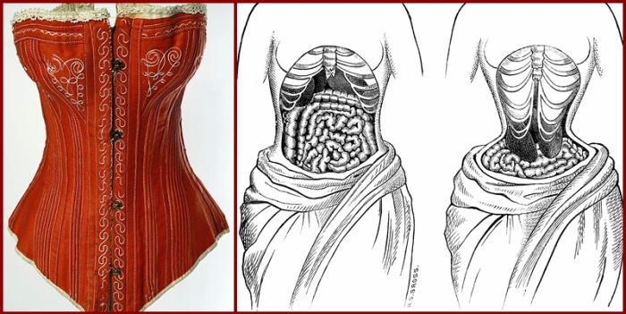 Самые ужасные жертвы, принесенные модницами Европы во имя красоты () Самые ужасные жертвы, принесенные модницами Европы во имя красоты