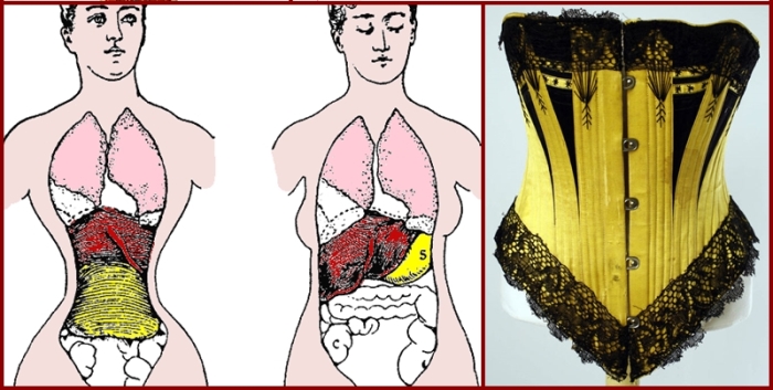 Самые ужасные жертвы, принесенные модницами Европы во имя красоты () Самые ужасные жертвы, принесенные модницами Европы во имя красоты
