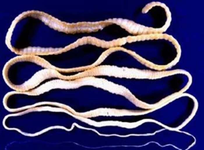 Самые ужасные жертвы, принесенные модницами Европы во имя красоты () Самые ужасные жертвы, принесенные модницами Европы во имя красоты