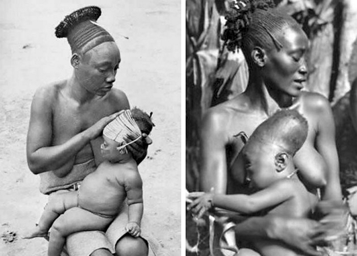 Обычай деформации черепа