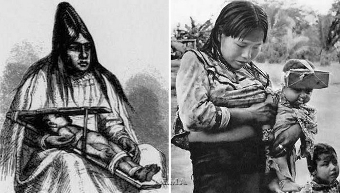 Разные способы деформации черепа