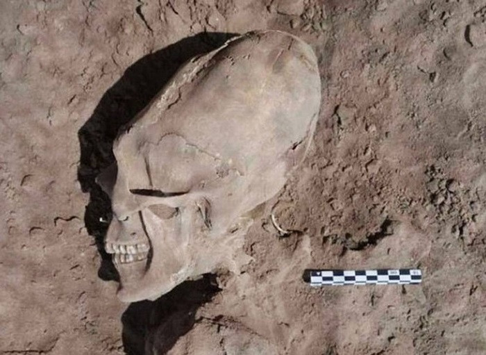 Деформированный череп