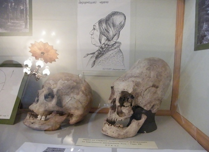 Обычай деформации черепа был распространен у индейцев