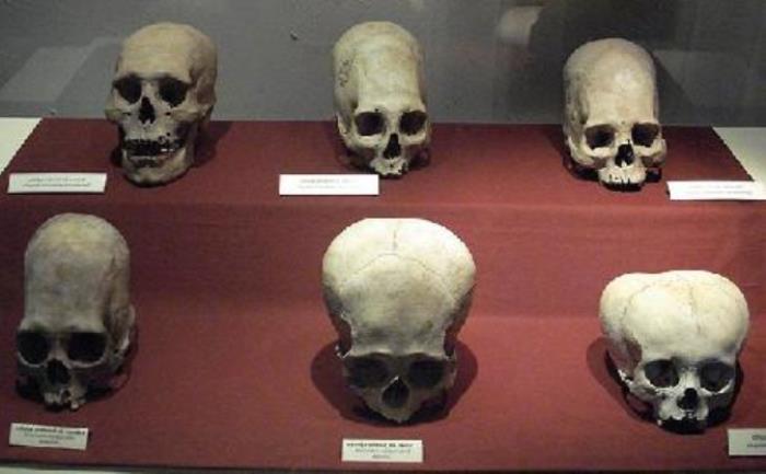 Разные виды деформации черепа