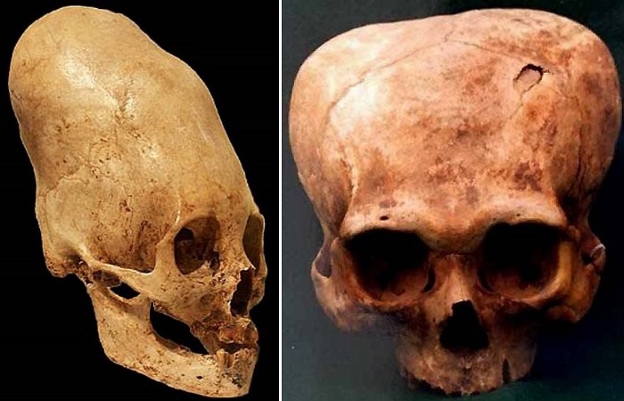 Разные способы деформации черепа