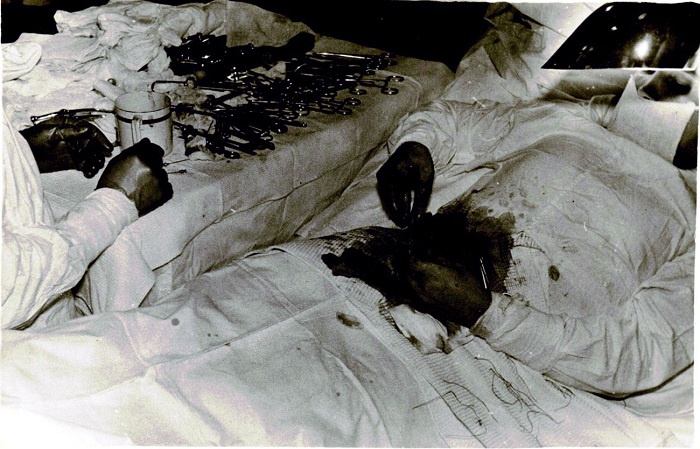 Операция по удалению аппендикса длилась 1 час 45 минут. | Фото: rarehistoricalphotos.com. Операция по удалению аппендикса длилась 1 час 45 минут. | Фото: rarehistoricalphotos.com.