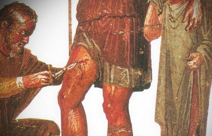 Греческий лекарь. / Фото:history-moments.ru Греческий лекарь. / Фото:history-moments.ru