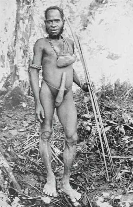 Обратите внимание на высокий лоб и глубоко сидящий нос. Обратите внимание на высокий лоб и глубоко сидящий нос.