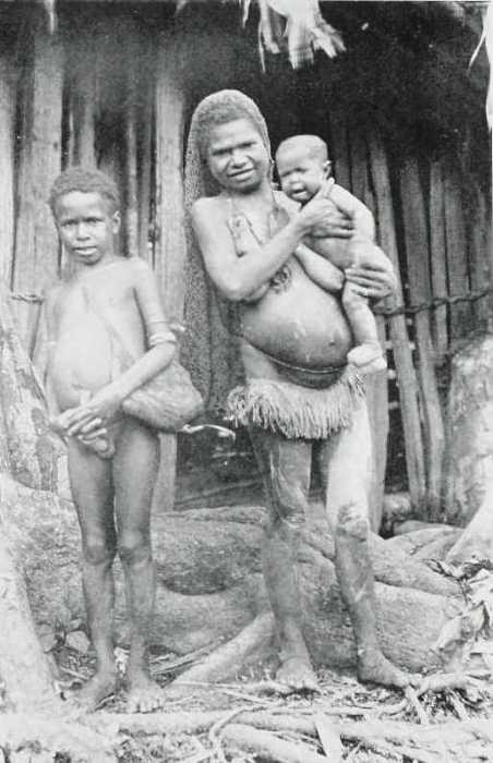 Указательный и средний пальцы левой руки Тогвиньо сильно повреждены. Указательный и средний пальцы левой руки Тогвиньо сильно повреждены.