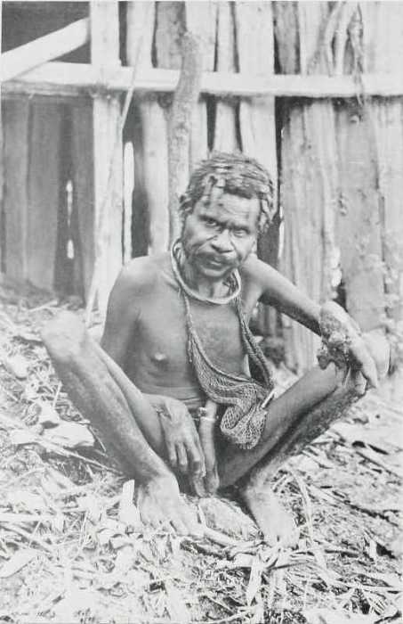 Мужчина одержим злым духом и сидит в центре круга из бревен, построенного колдуном. Мужчина одержим злым духом и сидит в центре круга из бревен, построенного колдуном.