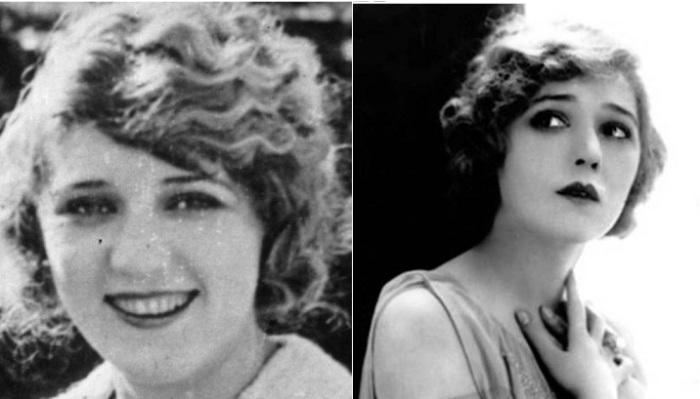 Мэри Пикфорд - актриса, которая после пластической операции потеряла способность улыбаться. | Фото: allday.com. Мэри Пикфорд - актриса, которая после пластической операции потеряла способность улыбаться. | Фото: allday.com.