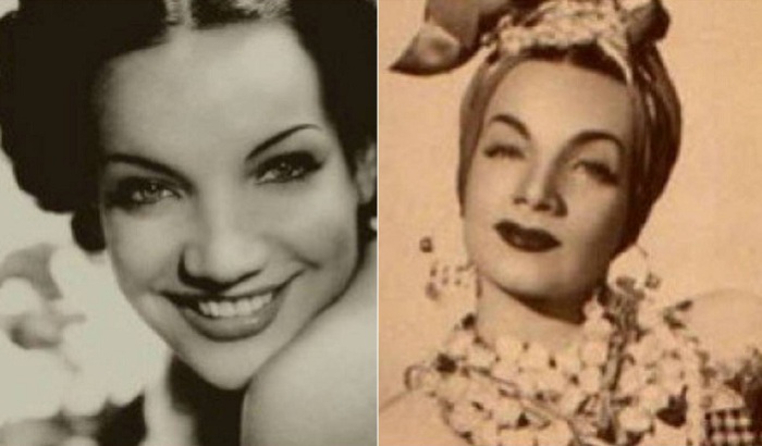 Кармен Миранда после пластической хирургии «заполучила» себе удивленное выражение лица. | Фото: allday.com. Кармен Миранда после пластической хирургии «заполучила» себе удивленное выражение лица. | Фото: allday.com.