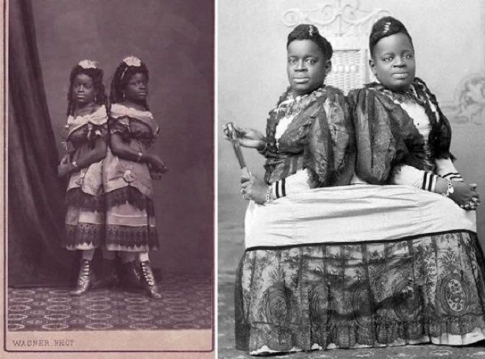 Мадам Саки - виртуозная канатоходка, популярная в XIX веке. | Фото: lichnosti.net. Мадам Саки - виртуозная канатоходка, популярная в XIX веке. | Фото: lichnosti.net.