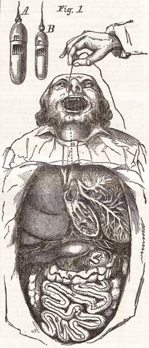 Ловушка доктора Мейерса для ловли паразитов. Патент 1854 года. | Фото: cabinetmagazine.org Ловушка доктора Мейерса для ловли паразитов. Патент 1854 года. | Фото: cabinetmagazine.org