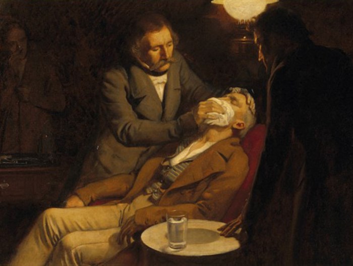 Удаление зуба с применением эфирного наркоза | Фото: farsipharm.com.ua Удаление зуба с применением эфирного наркоза | Фото: farsipharm.com.ua