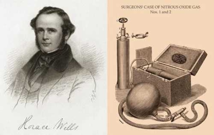 Гораций Уэллс и аппарат для наркоза | Фото: dr.arut.ru Гораций Уэллс и аппарат для наркоза | Фото: dr.arut.ru