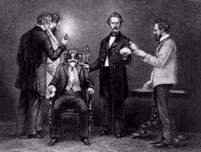 Удаление зуба с применением эфирного наркоза | Фото: cdn.lolwot.com Удаление зуба с применением эфирного наркоза | Фото: cdn.lolwot.com