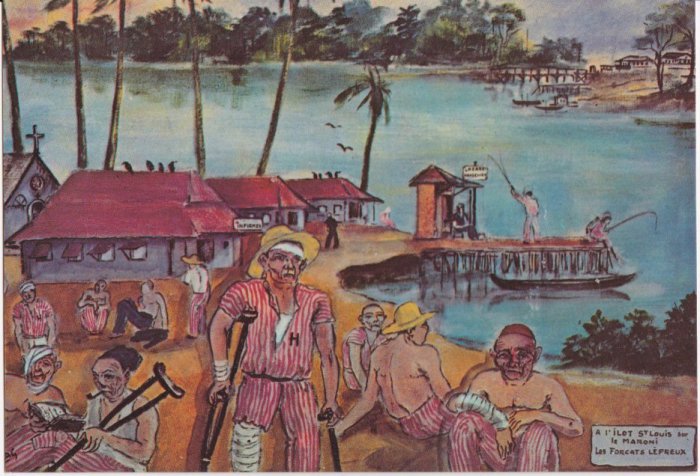 Заключенные, больные лепрой, Французская Гвиана. | Фото: avisa11.skyrock.com. Заключенные, больные лепрой, Французская Гвиана. | Фото: avisa11.skyrock.com.