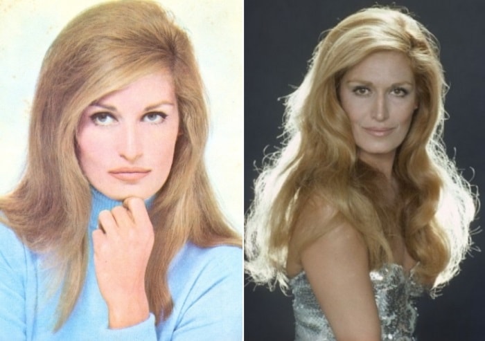 Далида | Фото: top-antropos.com и biography-life.ru Далида | Фото: top-antropos.com и biography-life.ru