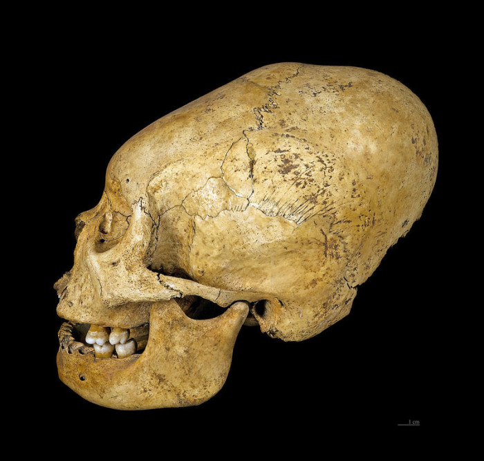 Модифицированный череп культуры прото-Наска. Перу, 200-100 гг. до н.э. | Фото: commons.wikimedia.org.
