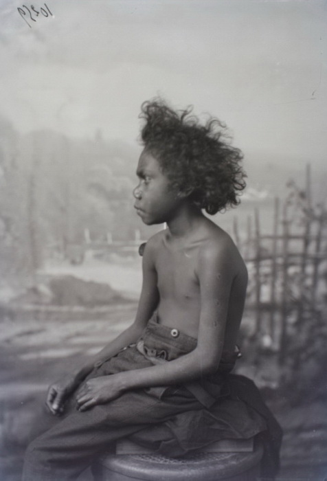 Документальное фото австралийца, которого содержали в человеческом зоопарке Документальное фото австралийца, которого содержали в человеческом зоопарке