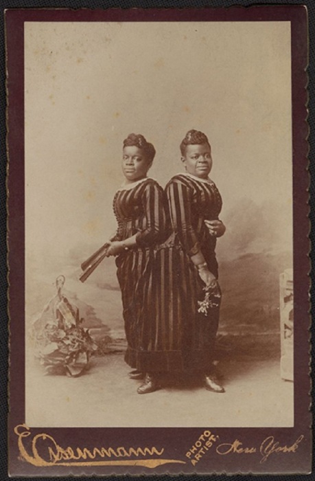 Портрет сиамских близнецов Милли и Кристины. Портрет сиамских близнецов Милли и Кристины.