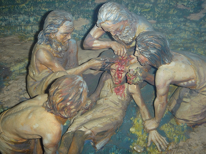 Древние эскулапы проводят операцию. Древние эскулапы проводят операцию.