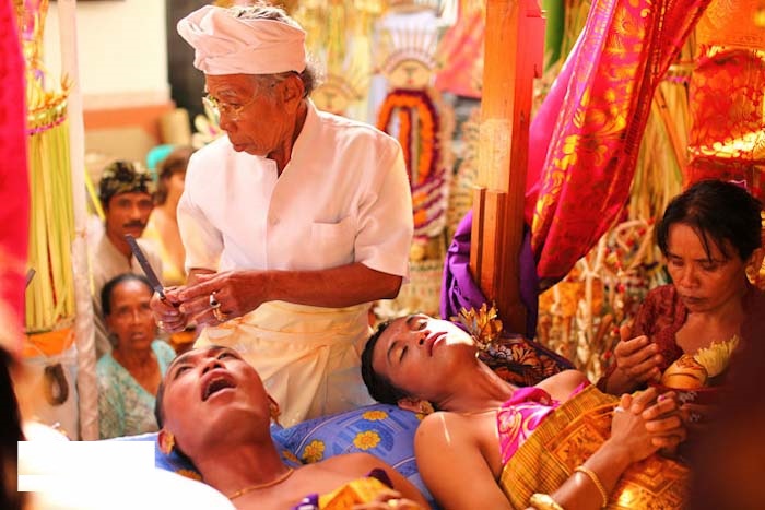 Стачивание зубов. | Фото: gfhome.ru. Стачивание зубов. | Фото: gfhome.ru.