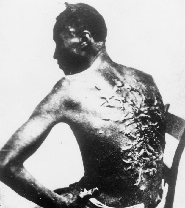 Питер, раб из Батон-Ружа, штат Луизиана, около 1863 года. Питер, раб из Батон-Ружа, штат Луизиана, около 1863 года.