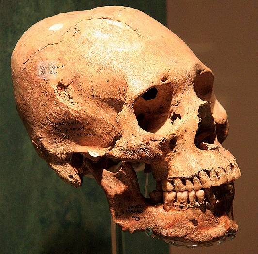 Головы мертвых рассказывают…