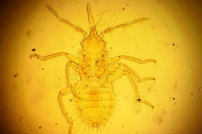 10 странных проблем, которые не давали спокойно жить древним людям