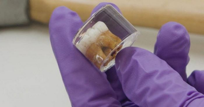 10 странных проблем, которые не давали спокойно жить древним людям