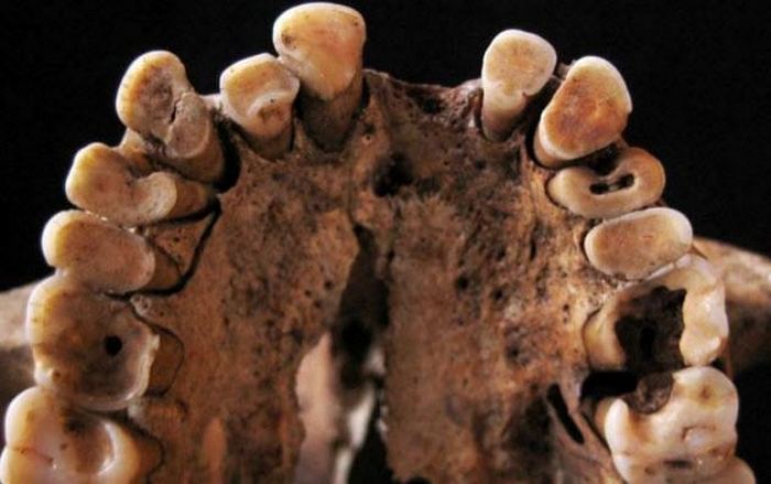 10 странных проблем, которые не давали спокойно жить древним людям