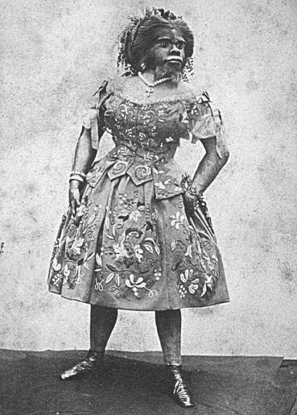 Откуда во Франции взялся принц, покрытый шерстью: Реальная история Чудовища, женатого на Красавице