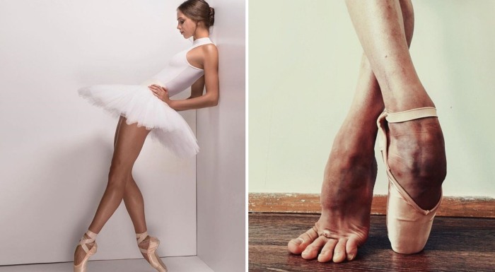 Ноги, ступни и пальцы — самые уязвимые части тела балерин