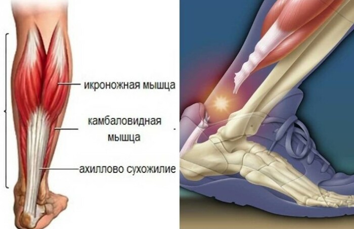 Сколько кг выдерживает Ахиллесова пята, которая стала уязвимым местом сына древнегреческой богини: Мифы и реальность